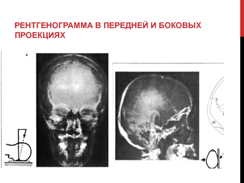 Латеральная проекция. Колгму Кафедра опер.хирургиии топогр.анатомии.