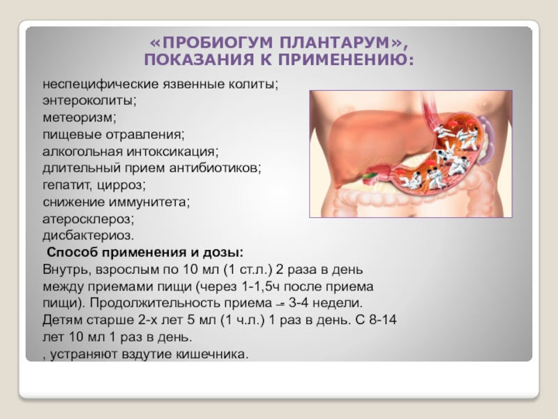 Симптомы энтероколита. Язвенно некротический энтероколит. Язвенный энтероколит. Показания к операции. Антибиотики против энтероколита.