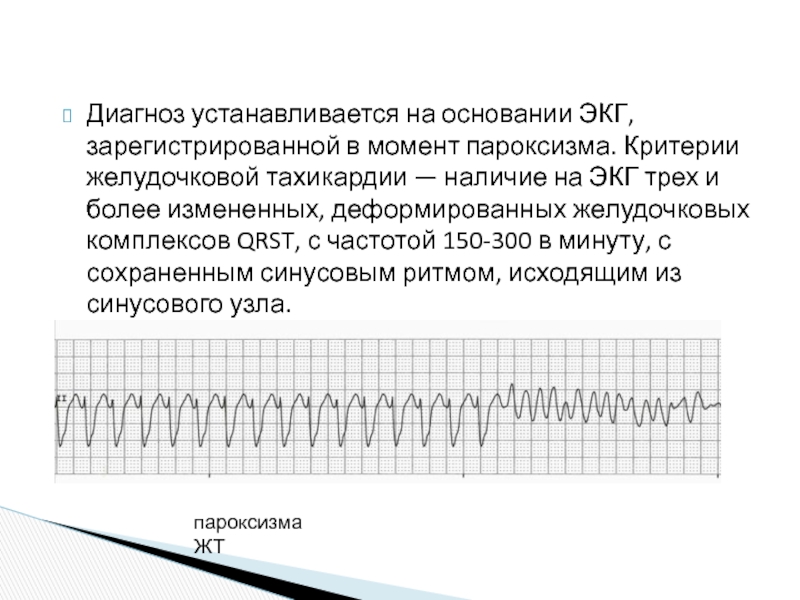 Желудочковая тахикардия экг фото