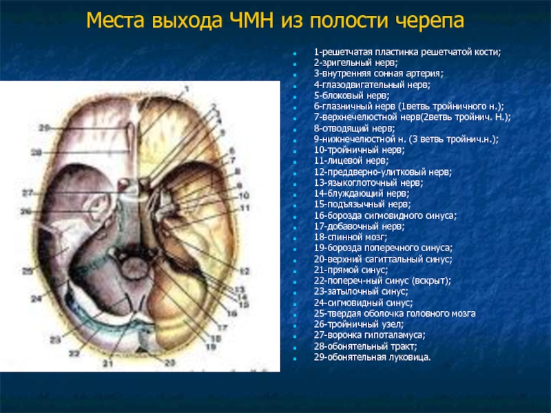 Черепные нервы череп. Топография Корешков черепных нервов. 12 Пар черепно-мозговых нервов анатомия на черепе. Череп анатомия 12 пар ЧМН. Основание черепа 12 пар ЧМН.