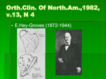 Orth.Clin. Of North.Am.,1982, v.13, N 4