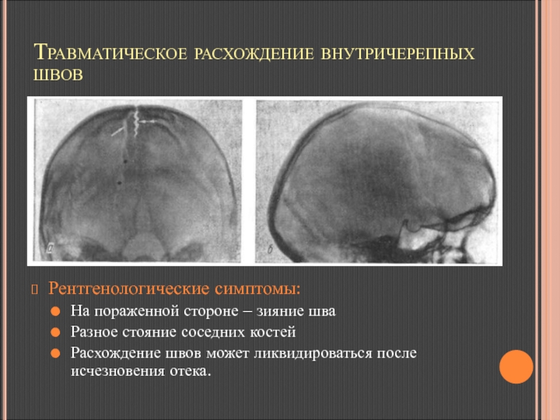 Расхождение швов после обрезания фото