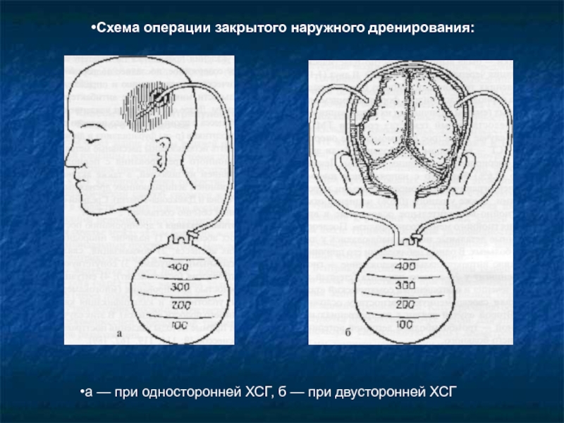 Схема кренлейна брюсовой топографическая