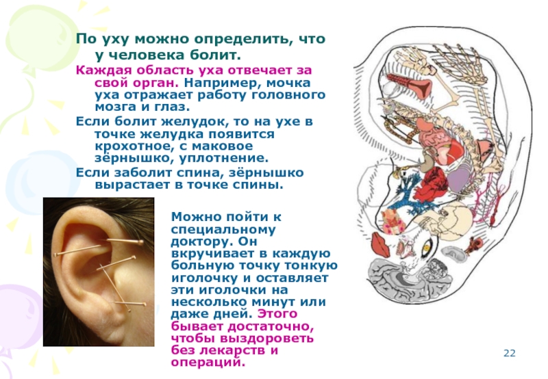 Органы на ушной раковине. Проекция органов на ушах. Проекция внутренних органов на ушной раковине. Схемой проекции внутренних органов на ушной раковине.