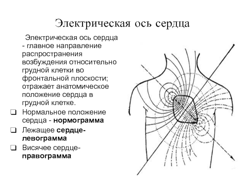 Электрическая ось сердца