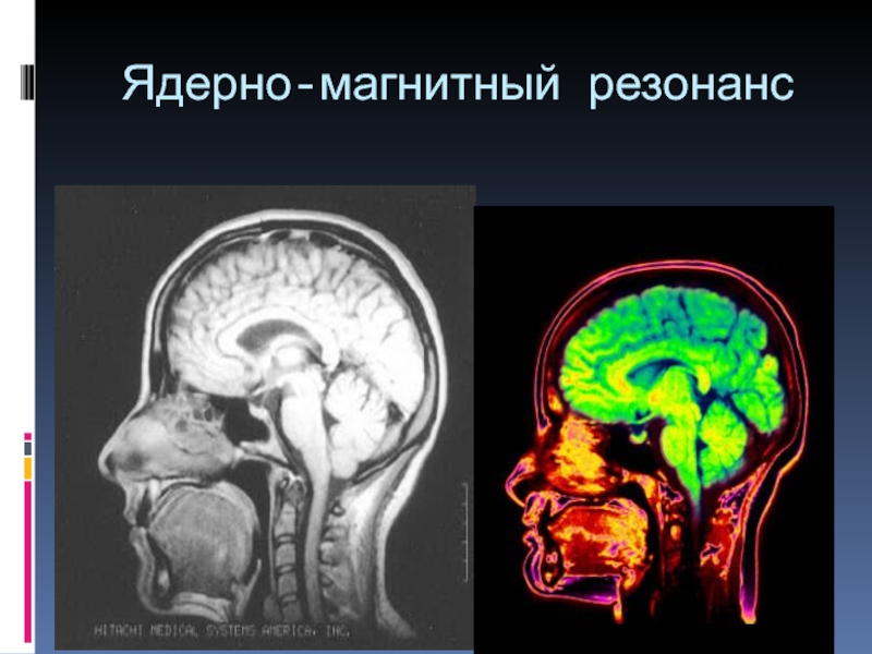 Магнитный резонанс. Магнитно-резонансная связь. Метод ядерно-магнитного резонанса фото.