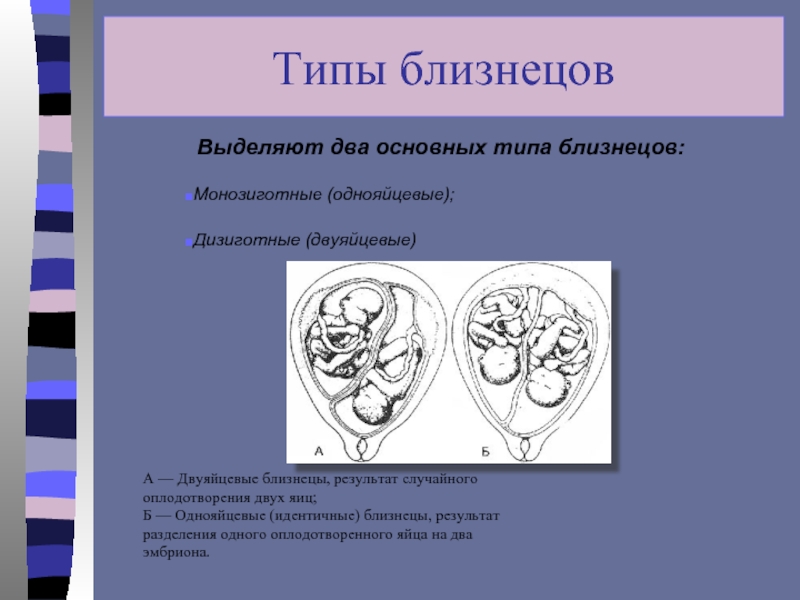 Однояйцевые близнецы презентация