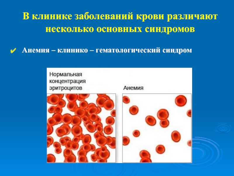Клиники заболеваний крови