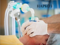 НАРКОЗ