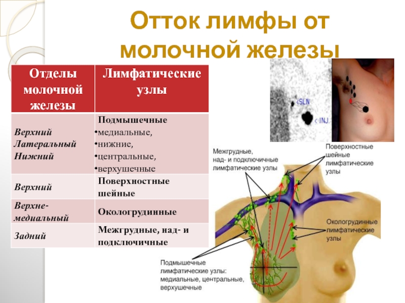 Схема лимфооттока от молочной железы