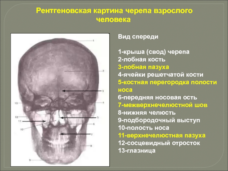 Вид спереди	1-крыша (свод) черепа 2-лобная кость 3-лобная пазуха 4-ячейки решетчатой кости 5-костная перегородка полости носа 6-передняя носовая