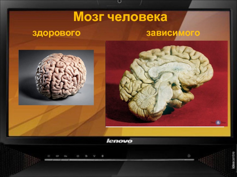 Мозг человеказдоровогозависимого