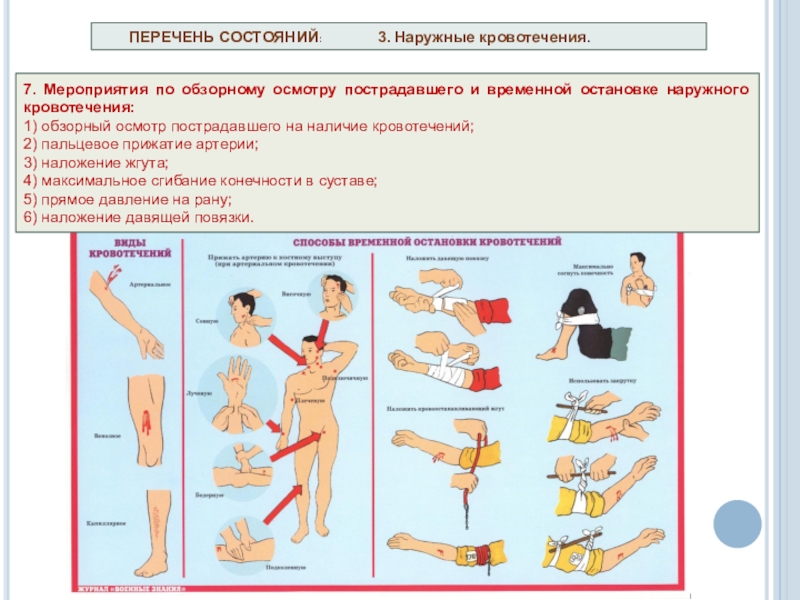 Фото остановка кровотечений
