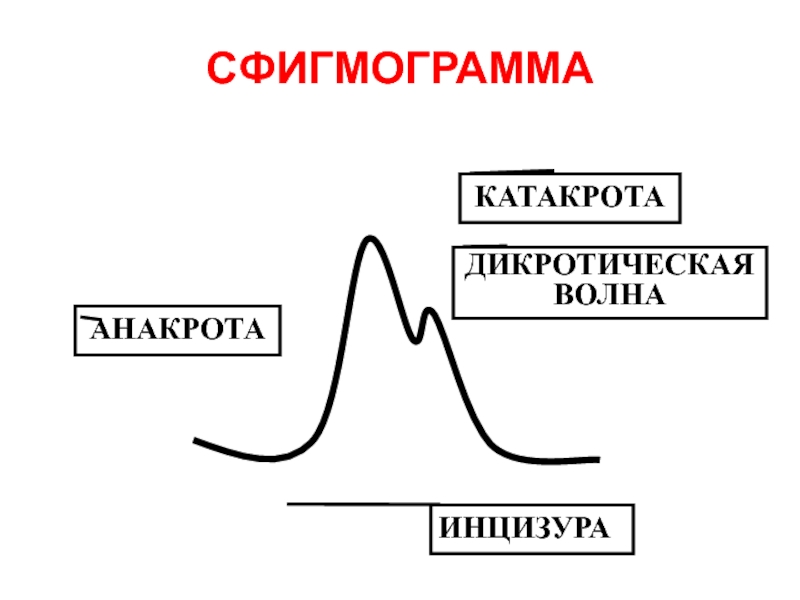 Дикротическая выемка