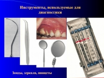 Инструменты, используемые для диагностики
Зонды, зеркала, пинцеты