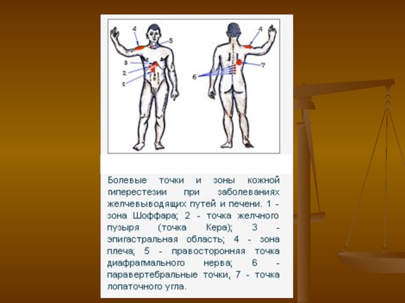 Точки балле. Болевые точки при поражении желчного пузыря. Болевые точки и зоны при заболеваниях желчевыводящих путей. Болезненные точки при патологии печени и жёлчного пузыря. Болевые точки при печени и желчевыводящих путей.