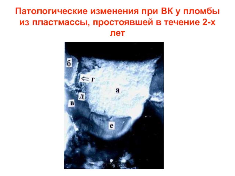 Патологические изменения это. Патологические изменения. Патоморфологические изменения при Глубоком кариесе:.