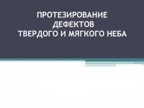 ПРОТЕЗИРОВАНИЕ ДЕФЕКТОВ ТВЕРДОГО И МЯГКОГО НЕБА