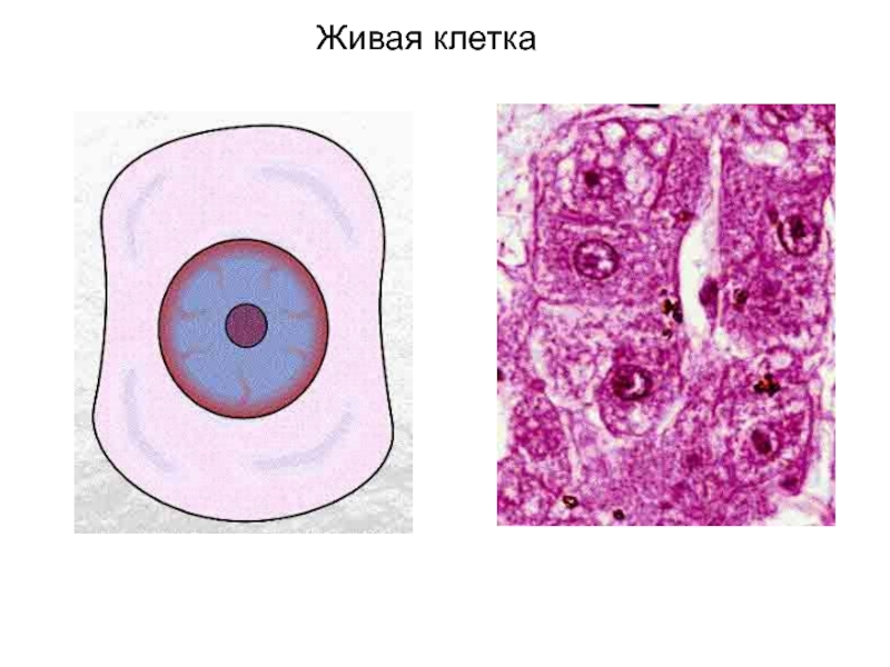 Гибель клеток некроз. Некроз клетки. Апоптоз и некроз.