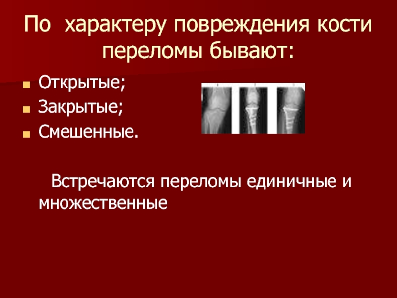 Повреждение костей. По характеру повреждения кости. По характеру повреждения кости переломы бывают. Характер повреждения костей. По характеру повреждения кости выделяют переломы полные.