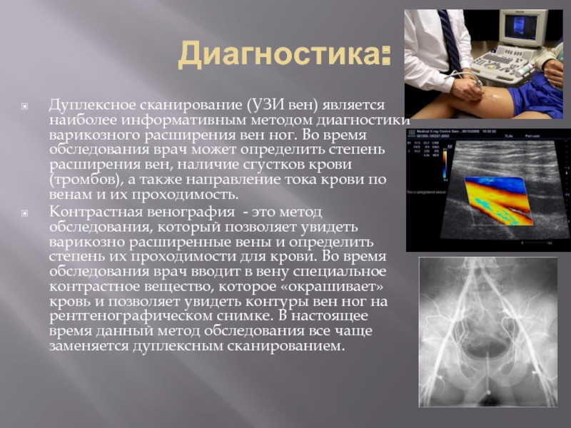 Наиболее информативным. Методы диагностики расширения вен. Наиболее информативным методом диагност. Наиболее информативный метод диагностики. Методика ультразвукового сканирования.