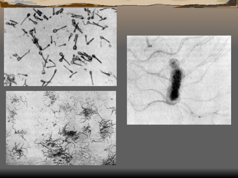 Столбняк возбудитель. Столбнячная палочка Clostridium tetani. Клостридиум тетани столбняк. Клостридии столбняка под микроскопом.