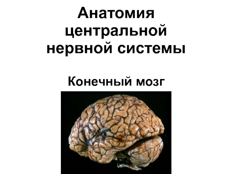 Анатомия центральной нервной системы Конечный мозг