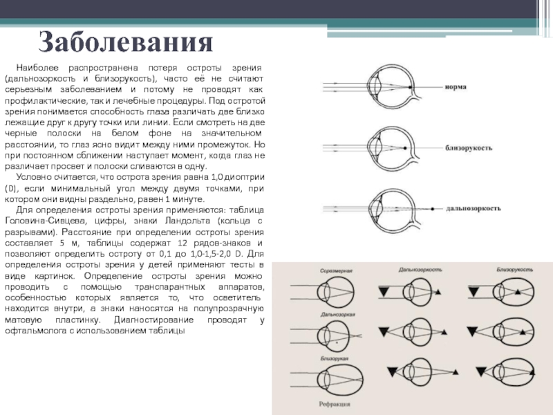 Зрение поле зрения острота зрения. Близорукость и дальнозоркость таблица. Таблица заболевания глаз близорукость и дальнозоркость. Дальнозоркость острота зрения. При близорукости (миопии) и дальнозоркости острота зрения.