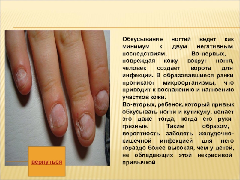 Продольные полосы на ногтях о чем говорят. Заболевания ногтей на руках таблица.