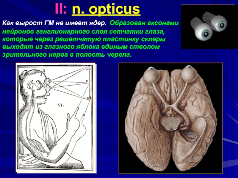 Зрительный нерв неврология презентация