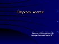 Опухоли костей