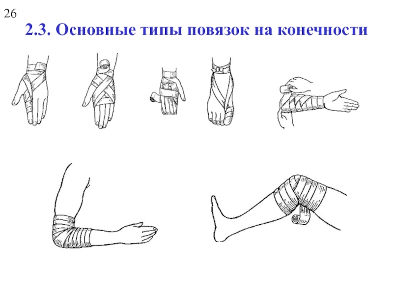 Виды повязок. Основные типы повязок. Повязка на нижнюю конечность ноги. Виды повязок на нижние конечности. Основные типовые повязки.