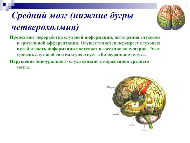 Презентация гностические слуховые расстройства