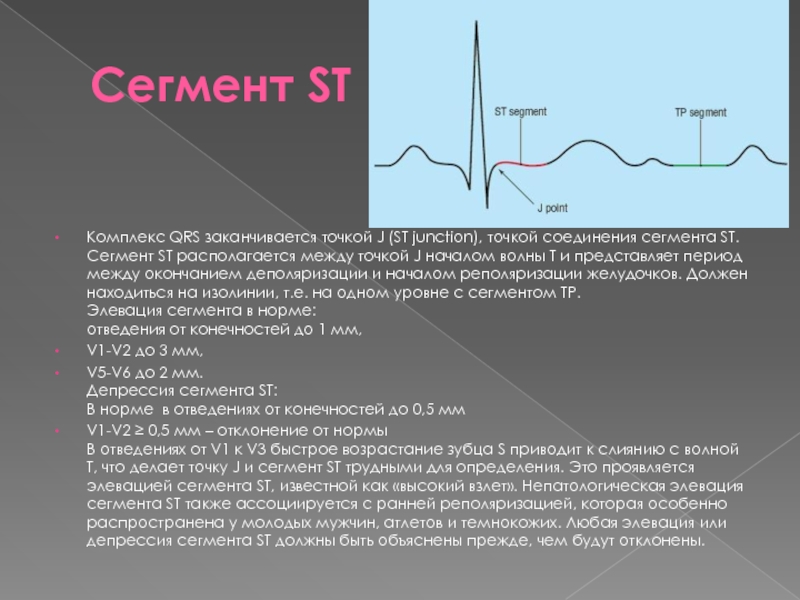 Сегмент st на экг