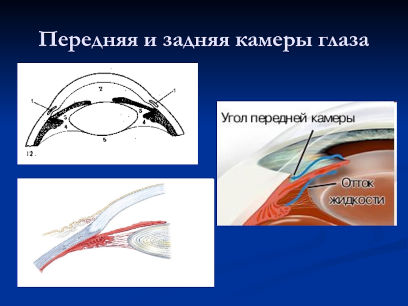 Передняя камера глаза. Реконструкция передней камеры глаза. Парацентез передней камеры глаза. Фиброз передней камеры глаза. Классификация угла передней камеры глаза.