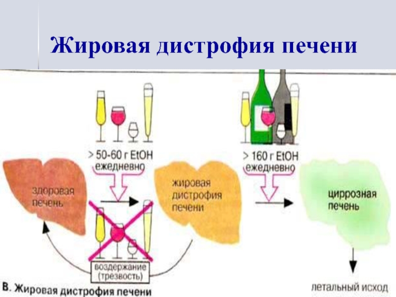 Биохимия печени. Жировое Перерождение печени биохимия. Механизм развития жировой дистрофии печени. Механизм развития алкогольной жировой дистрофии печени. Жировая инфильтрация печени биохимия механизм.