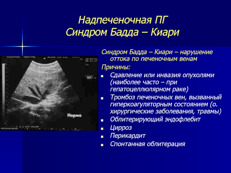 Синдром бадда киари презентация