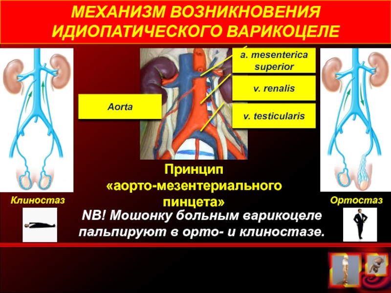 Тромбоз мезентериальных сосудов карта вызова смп