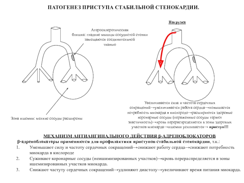 Увеличивают силу сердечных сокращений. Патогенез стабильной стенокардии напряжения. Прогрессирующая стенокардия патогенез. Расширяет коронарные сосуды и улучшает доставку кислорода к сердцу. Увеличение коронарных артерий при повышении потребности сердца.