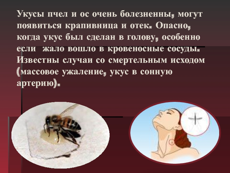 Снять укус пчелы. Укусы насекомых и защита от них. Крапивница от укусов насекомых.