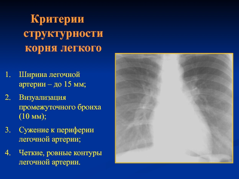 Критерии структурности легочного рисунка