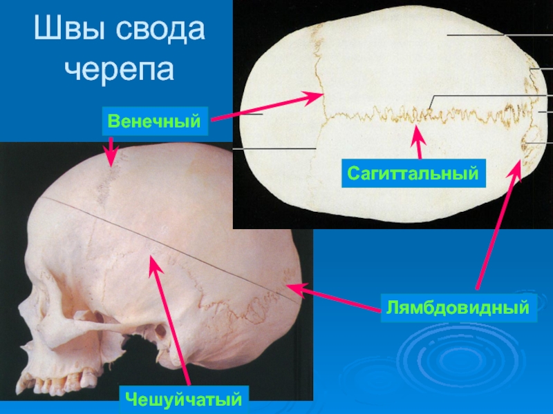 Швы черепа анатомия картинки