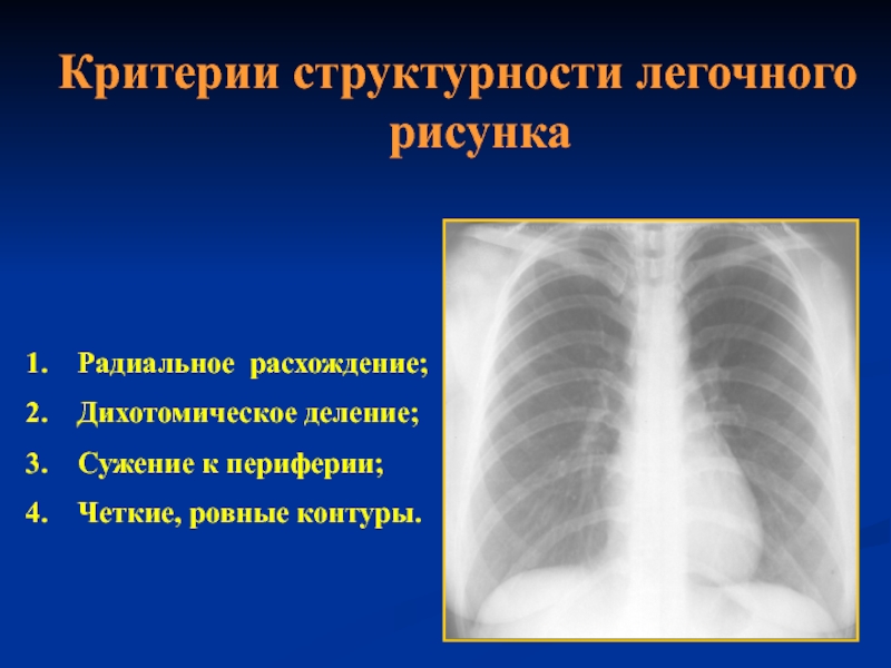 Критерии структурности легочного рисунка