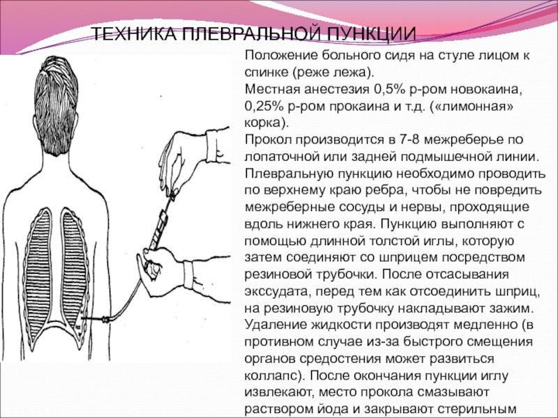 В положении проводимого. Пункция плевральной полости техника. Методика проведения плевральной пункции. Плевральная пункция при гидротораксе. Лечебно диагностическая пункция плевральной полости.