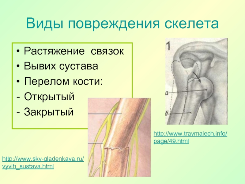 Какой вид травмы изображен на рисунке