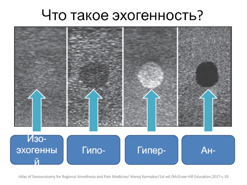 Что значит повышенная эхогенность. Эхогенность. Эхогенная структура что это. Эхогенность на УЗИ. Эхогенные структуры на УЗИ.