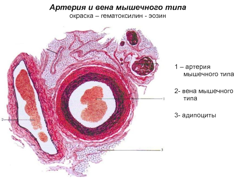 Артерия мышечного типа гистология рисунок с подписями