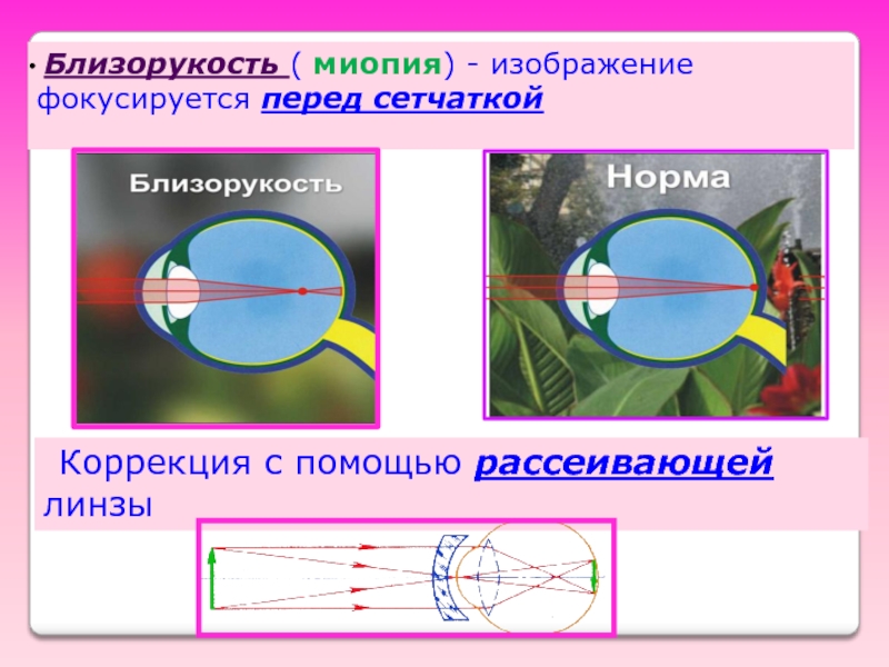 При близорукости изображение предметов появляется