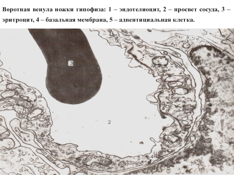 Воротная венула ножки гипофиза: 1 – эндотелиоцит, 2 – просвет сосуда, 3 –