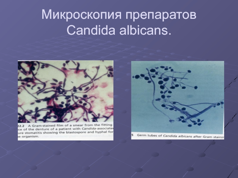 Препарат candida